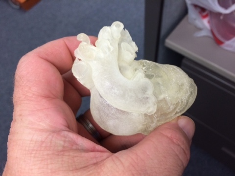 The fine, delicate features of pediatric hearts create unique challenges for surgical planning, making the availability of a patient-specific 3D printed replica extremely important to the process. (Photo: Business Wire)