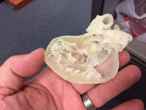 The fine, delicate features of pediatric hearts create unique challenges for surgical planning, making the availability of a patient-specific 3D printed replica extremely important to the process. (Photo: Business Wire)