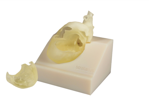 3D printed replicas of pediatric hearts allow physicians to evaluate and interact with patient anatomy in ways 2D images cannot. (Photo: Business Wire)
