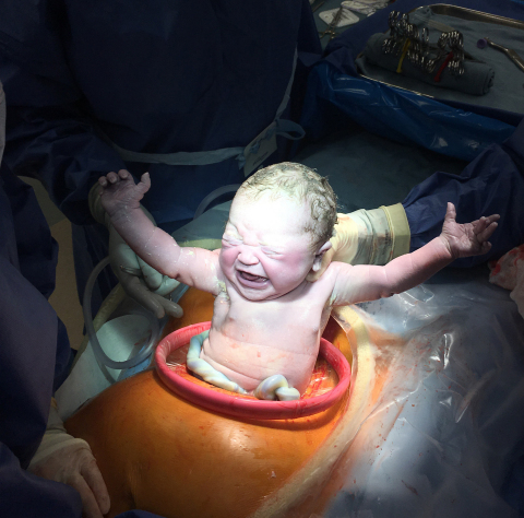 Cesarean birth using Applied Medical’s Alexis® O C-Section Protector/Retractor. Photo courtesy of C. Steele.