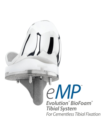 Evolution BioFoam Tibial System for Cementless Tibial Fixation (Photo: Business Wire).