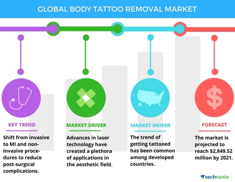 Technavio has published a new report on the global tattoo removal market from 2017-2021. (Graphic: Business Wire)