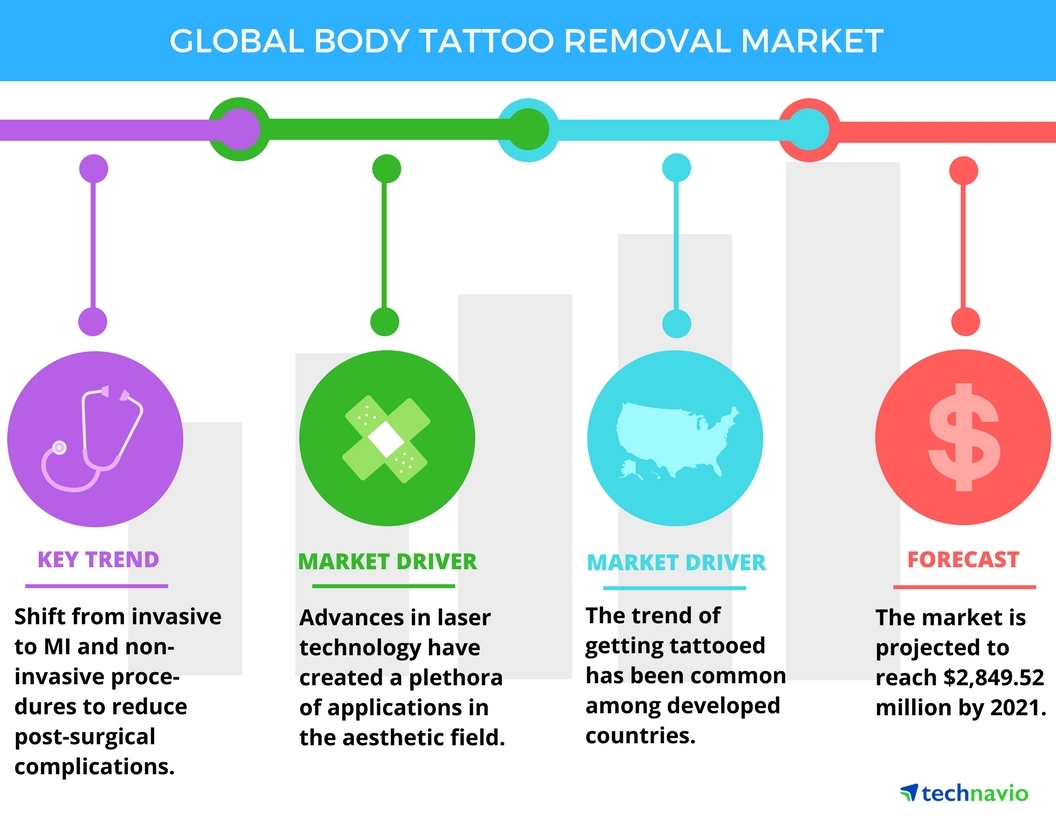 Laser Tattoo Removal - Astanza