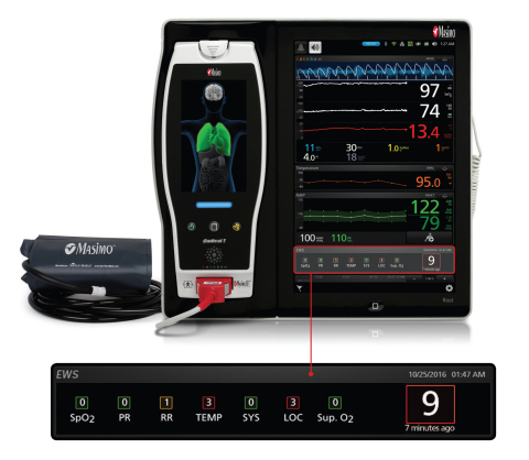 Masimo Root® Patient Monitoring and Connectivity Hub with Early Warning Score (EWS)(Photo: Business Wire)