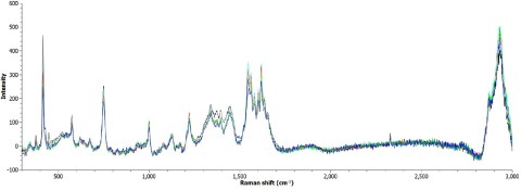 Example of Raman spectra from tumor surgery (Photo: Business Wire)