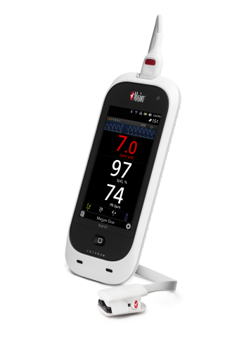 Masimo Rad-67™ Handheld Pulse CO-Oximeter® with rainbow® DCI®-mini Sensor (Photo: Business Wire)