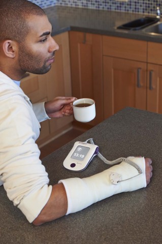 A patient treats his nonunion fracture with LIPUS using the EXOGEN Ultrasound Bone Healing System. (Photo: Business Wire)