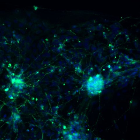 Human neurons shown on the Emulate Brain-Chip will used in studies in space to assess how stressors influence brain function, in space and in human diseases. (Photo: Business Wire).