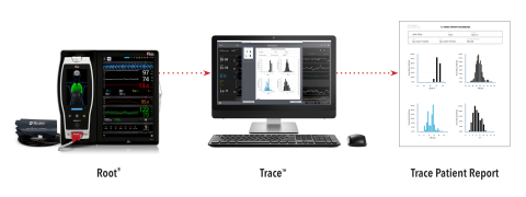  Masimo Trace™ Data Visualization and Reporting Tool (Photo: Business Wire)