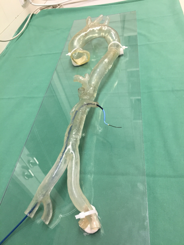 Transparent Stratasys 3D printed model of a patient-specific aortic arch, used by the University Hospital Mainz to practice complex endovascular surgeries. (Photo: Business Wire)