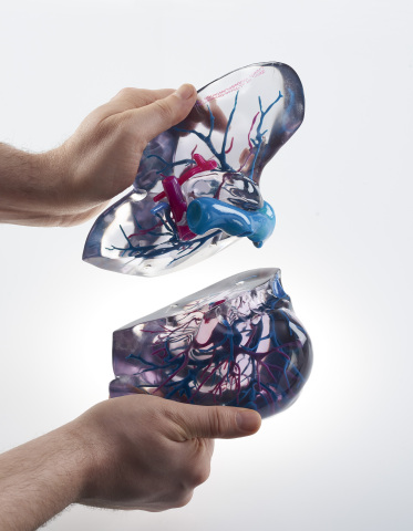 3D printed medical model mitigates risk, enabling physicians to see hidden critical structures. (Pho ... 