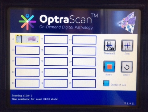 Single-touch, interactive, LCD user interface (auto-detect tissue AOI's) (Graphic: Business Wire)