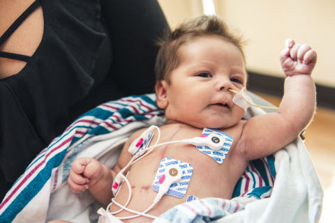 Baby Jasmine was born in late December with hypoplastic left heart syndrome (HLHS) and had her first open-heart surgery at five days old. She is enrolled in the groundbreaking clinical trial at Children’s Hospital Los Angeles (Photo: Business Wire)