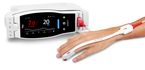 Masimo Radical-7® Pulse CO-Oximeter® with rainbow SET™ PVi® (Photo: Business Wire)