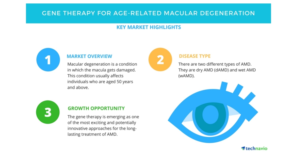 Gene Therapy for Age-related Macular Degeneration - Pipeline Analysis ...