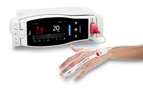 Un Estudio Nuevo Investiga el Desempeño de Masimo SpHb® Durante el Sangrado Agudo y tras la Reanimación con Líquidos