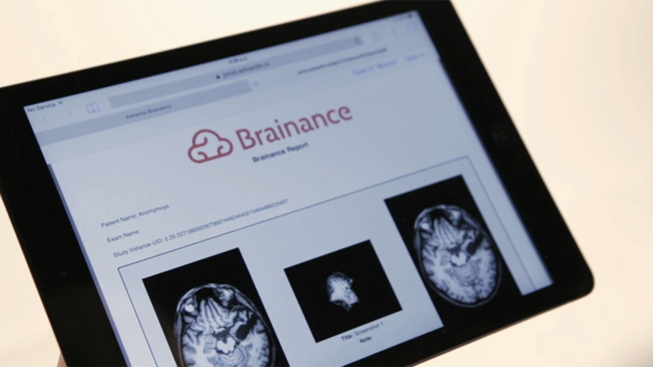 Brainance® MD | Advanced Cloud-Based Neuroimaging Software designed for the Clinical Workflow

