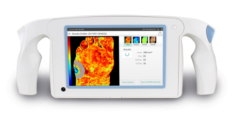 HyperView Imaging System. (Photo: Business Wire)