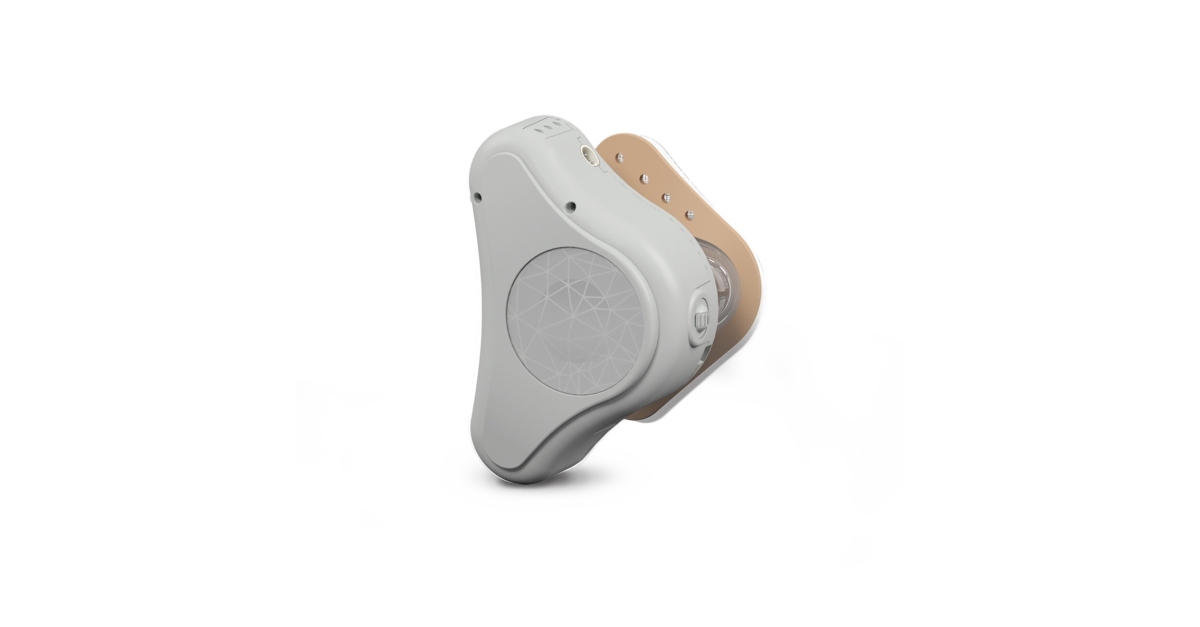 MED-EL USA Receives FDA Clearance for ADHEAR, a Revolutionary Non ...