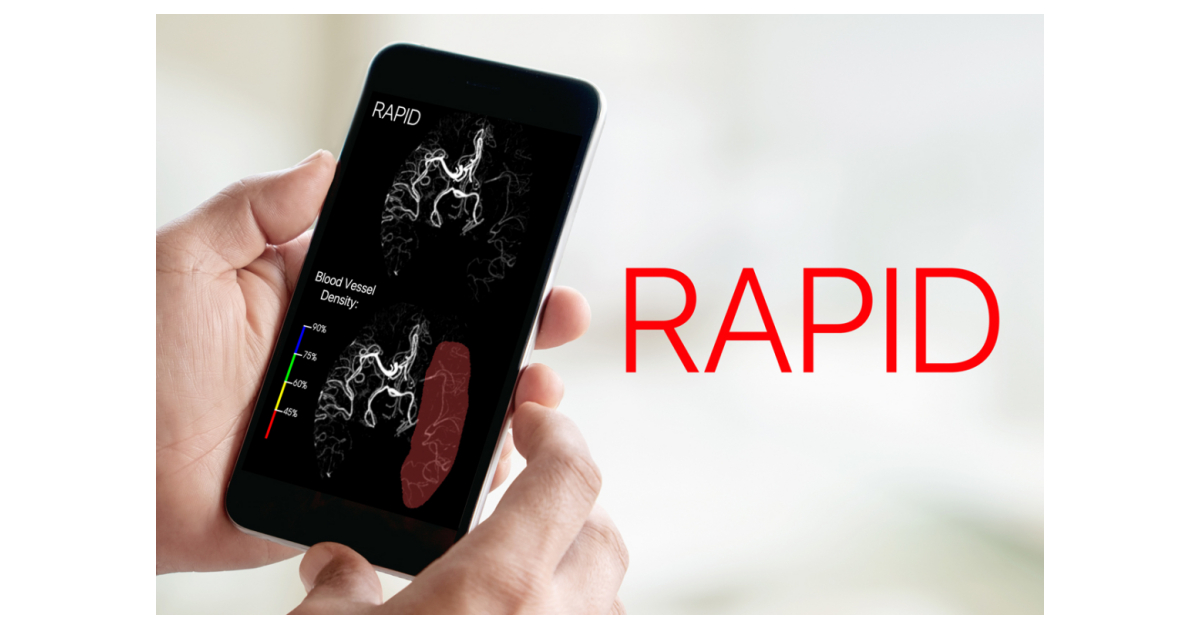 iSchemaView Receives FDA Clearance for RAPID CTA Business Wire