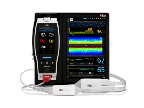 Masimo Root® Patient Monitoring and Connectivity Platform with SedLine® Brain Function Monitoring and O3® Regional Oximetry (Photo: Business Wire)