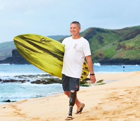 Unum customer David Connor never expected to be in a position where he couldn't work, but a routine task at work altered his life forever. His disability coverage helped provide financial stability while he took time away from work to recover. He's now working again and has returned to his passion - surfing. (Photo: Business Wire)