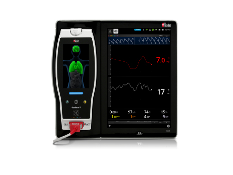 Un nuevo estudio investiga la utilidad de la medición continua de la hemoglobina no invasiva con Masimo SpHb® para reflejar la hemodilución iatrogénica en tiempo real durante la administración incremental de fluidos