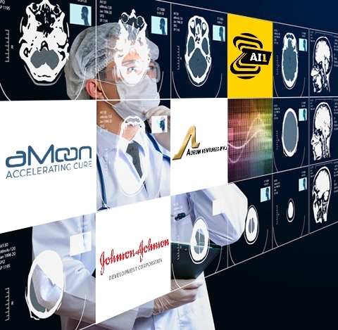 Zebra Medical Vision Raises $30M, unveils the broadest, automated AI based Radiology Chest X-Ray reader to date (Photo: Zebra-Med) 