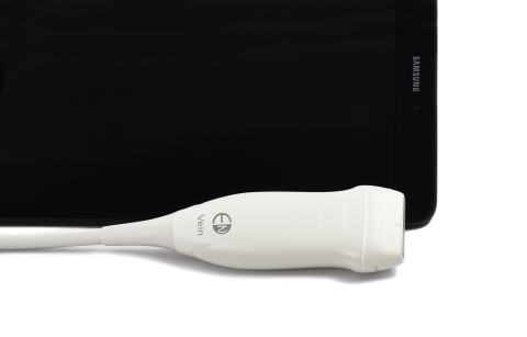 EchoNous has received U.S. FDA 510(k) clearance for the EchoNous Vein™, an ultrasound-based tool designed specifically for nurses to improve peripheral IV (PIV) catheter placements. (Photo: Business Wire)