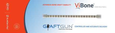 ViBone, a viable bone allograft produced by Aziyo Biologics, is now available for use with SurGenTec’s minimally invasive bone graft delivery system, GraftGun.  The system is designed to allow for universal, quick and accurate bone graft delivery to a surgical site. (Graphic: Business Wire)