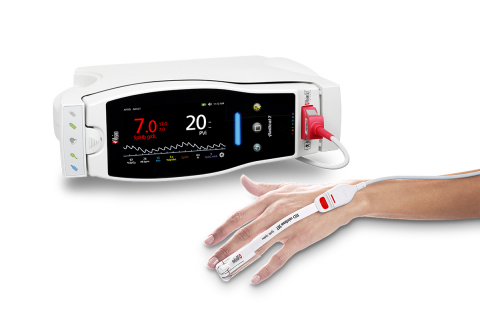 Un Nuevo Estudio Investiga la Utilidad de Masimo PVi® como Parte del Manejo de Líquidos Dirigido al Objetivo en Pacientes Sometidos a Cirugía Colorrectal