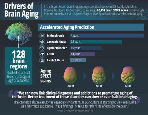 Drivers of Brain Aging (Graphic: Business Wire)