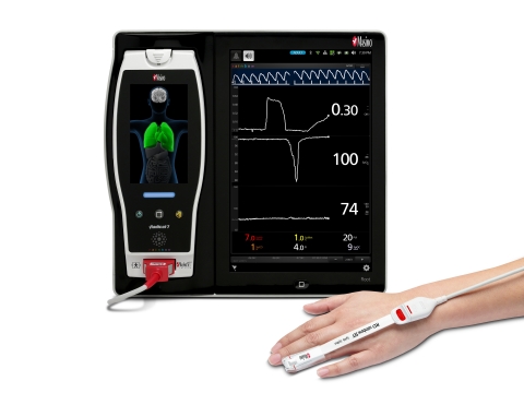 Un nuovo studio valuta la capacità dell’ORi™ di Masimo di aiutare il personale medico a ridurre l’iperossiemia nei pazienti delle unità di terapia intensiva ventilati meccanicamente