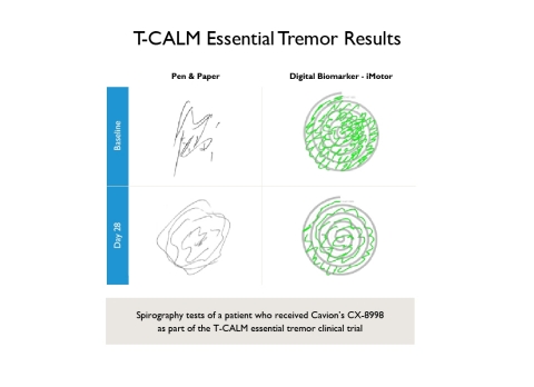 T-CALM Essential Tremor Results (Graphic: Business Wire)