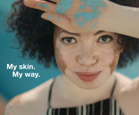 #MySkinMyWay (Photo: Business Wire) 