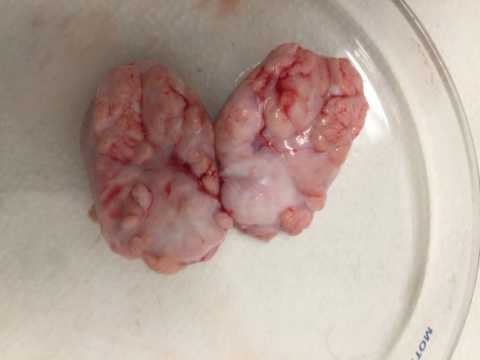 The 3D printed human brain organelle was generated with human adult brain stem cells. The 3D printed human brain organelle was printed with special bio matrix gel material CEP707 consisting of human brain stem cells, brain extracellular matrix and media. The 3D printed human brain organelle is now routinely used for toxicology and drug discovery programs at Celprogen. This model system is also utilized for studying various kinds of brain cancers. This 3D printed brain model system is a very unique model system for testing how the drugs are able to transverse the blood brain barrier. (Photo: Business Wire)