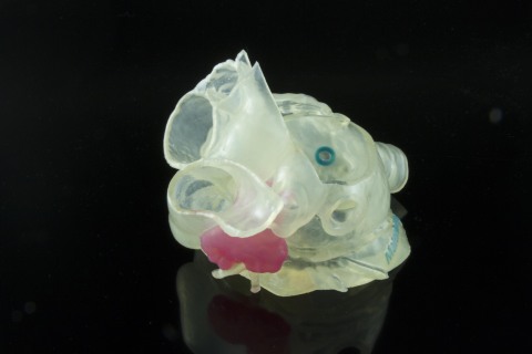 Model of patient's left atrial appendage (LAA) created with Stratasys and Materialise technology is  ... 