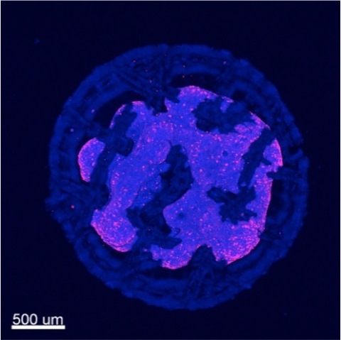 Tumor growth on Prellis' 2mm x 1mm Organoid™ after 48 hours (Photo: Business Wire)