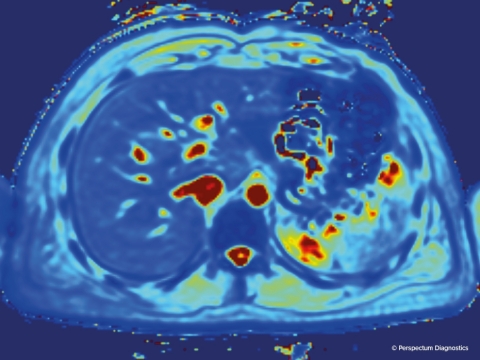 LiverMultiScan image (Photo: Business Wire)