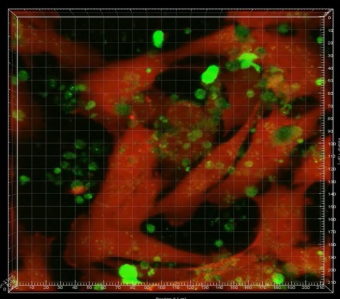 Fluorescent image showing leukemia cells (green) hiding in bone marrow (red). Image courtesy of Dr. Yong-Mi Kim, CHLA