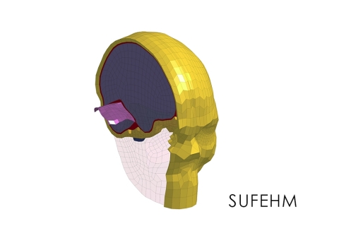 Strasbourg University Finite Element Head Model - Head Injury Prediction Tool (Photo: Business Wire)