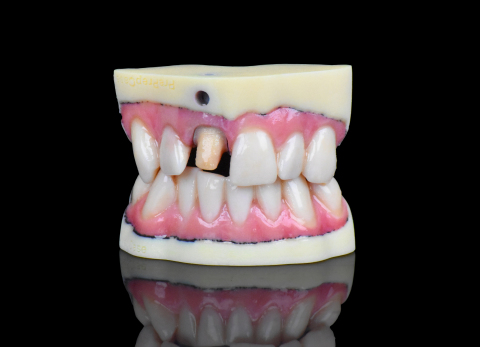The new Stratasys J720 Dental 3D Printer sets new standards in realism for digital dentistry – leveraging more than 500,000 color combinations. (Photo: Business Wire)