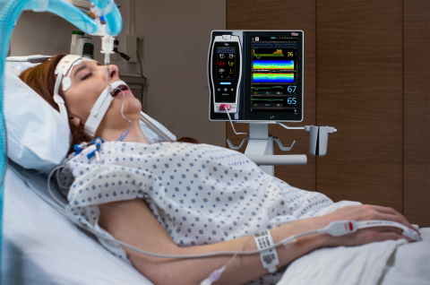 Masimo Root® with SedLine® and O3® (Photo: Business Wire)