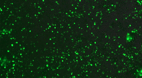 Expression of PCR-generated Green Fluorescent Protein (GFP) gene fragment in hundreds of human T cel ... 