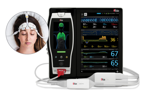 Masimo Root® with O3® Regional Oximetry and Next Generation SedLine® Brain Function Monitoring (Graphic: Business Wire)