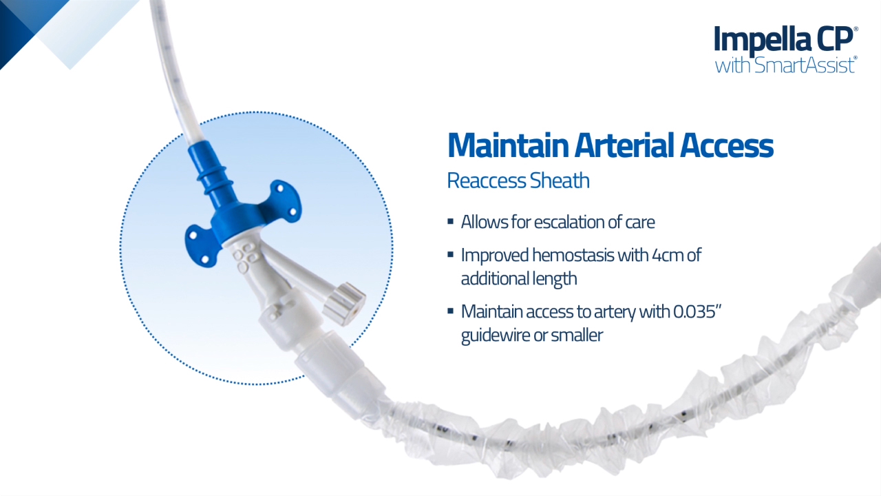 Impella Smartassist Platform Launches At Scai Designed To Further Improve Patient Outcomes Business Wire