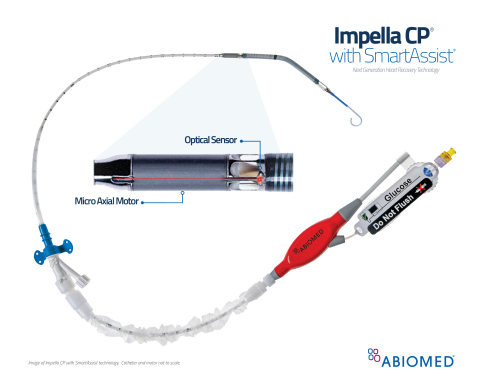 Impella SmartAssist Platform Launches at SCAI, Designed to Further Improve Patient Outcomes (Graphic: Abiomed, Inc.)