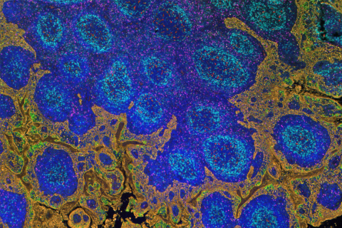 FFPE IF of tonsil, 6-plex + DAPI. Total staining time: 4h12 (with Opal® 7-Color Manual IHC Kit) (Pho ... 