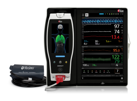 Masimo Root® Patient Monitoring and Connectivity Platform (Photo: Business Wire)