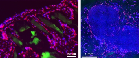 STRUCTURE TRANSPLANT:  Prellis structure transplanted alone is surrounded by single cell walled capillaries within two weeks of transplantation into immunocompetent mouse (left). Human tumor cells transplanted in Prellis structures grow rapidly, are highly vascularized and demonstrate minimal hypoxia (right) (red = CD31, blue = DAPI, green = printed structure)  [Press Release Image: Prellis Biologics]